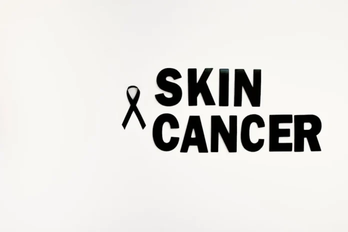 Black ribbon and text highlighting skin cancer awareness on a white background.