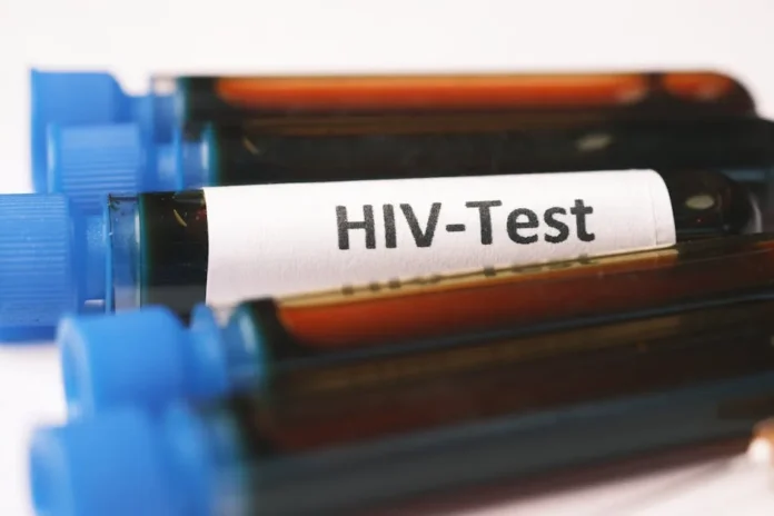 HIV คืออะไร