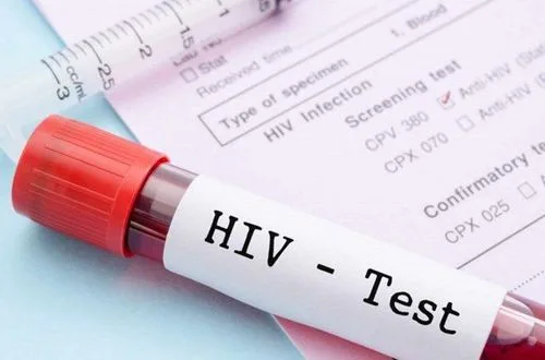 เข้ารับการตรวจ HIV ตั้งแต่เนิ่นๆ เพื่อวินิจฉัยโรค