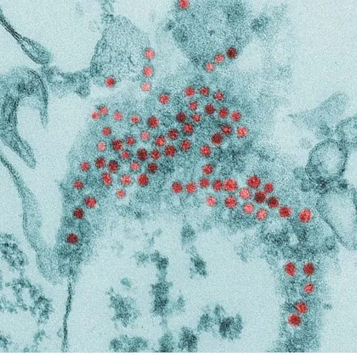 ภาพแสดงเชื้อไวรัส Enterovirus 71